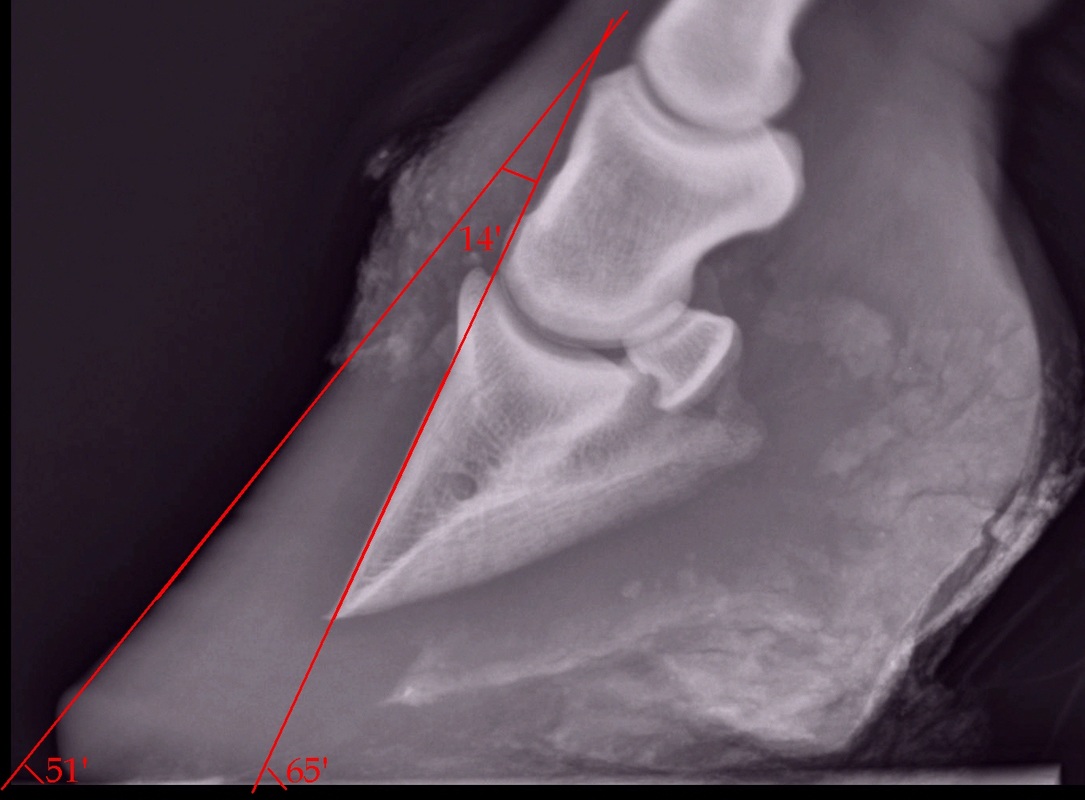 X-Ray Both Heel Lat View | Test Price in Delhi | Ganesh Diagnostic